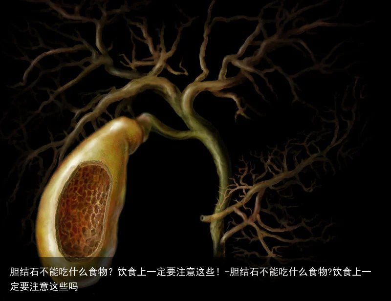 胆结石不能吃什么食物?饮食上一定要注意这些!-胆结石不能吃什么食物?饮食上一定要注意这些吗
