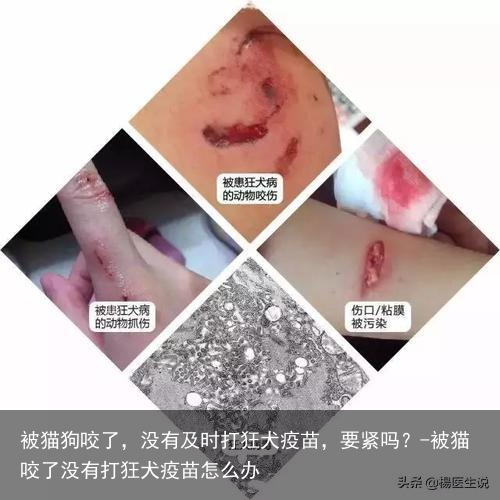 被猫狗咬了,没有及时打狂犬疫苗,要紧吗?-被猫咬了没有打狂犬疫苗怎么办
