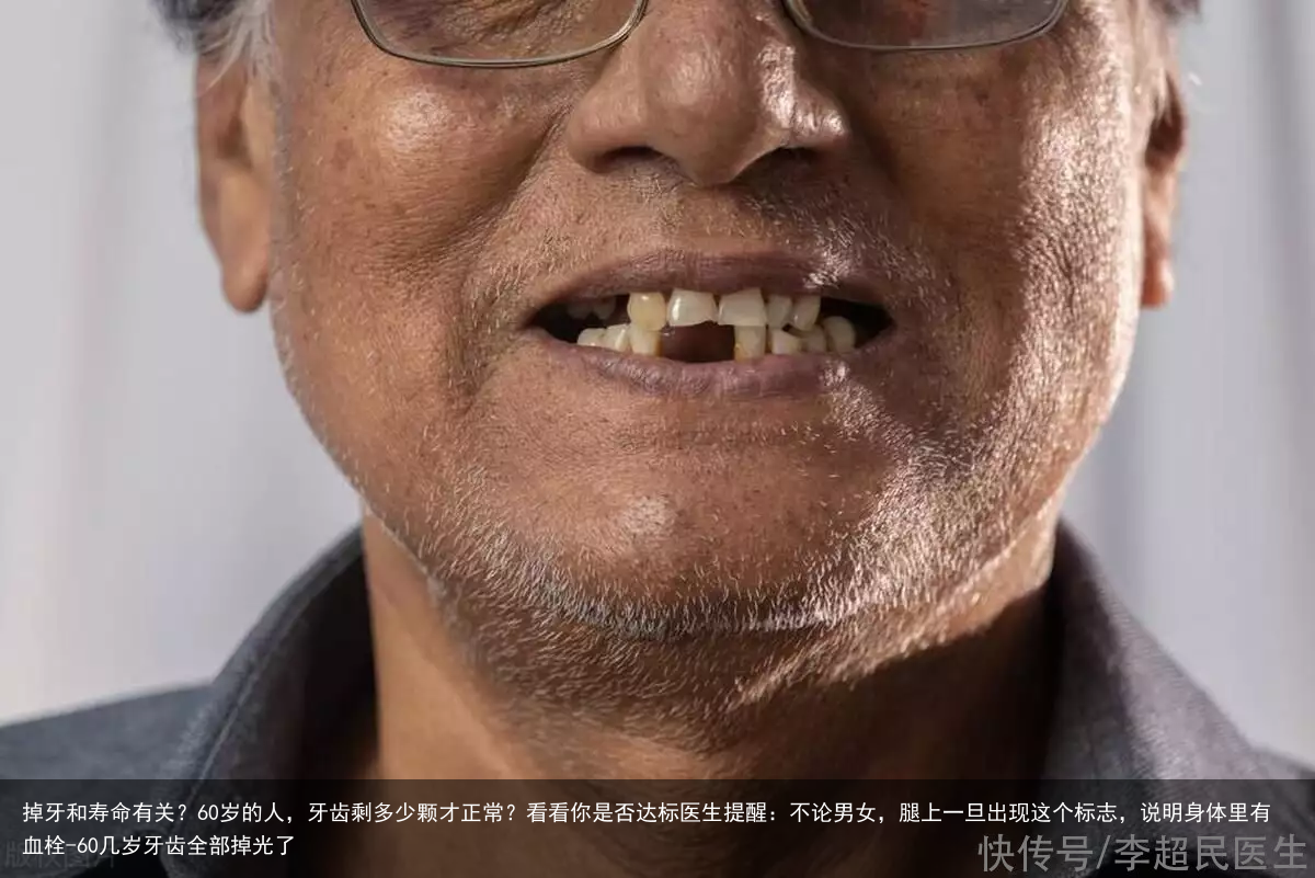掉牙和寿命有关?60岁的人,牙齿剩多少颗才正常?看看你是否达标医生提醒:不论男女,腿上一旦出现这个标志,说明身体里有血栓-60几岁牙齿全部掉光了