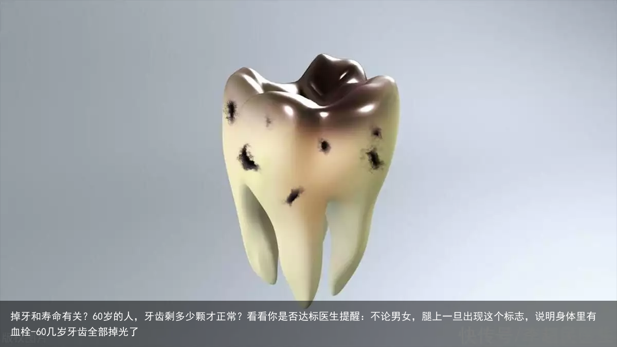 掉牙和寿命有关?60岁的人,牙齿剩多少颗才正常?看看你是否达标医生提醒:不论男女,腿上一旦出现这个标志,说明身体里有血栓-60几岁牙齿全部掉光了