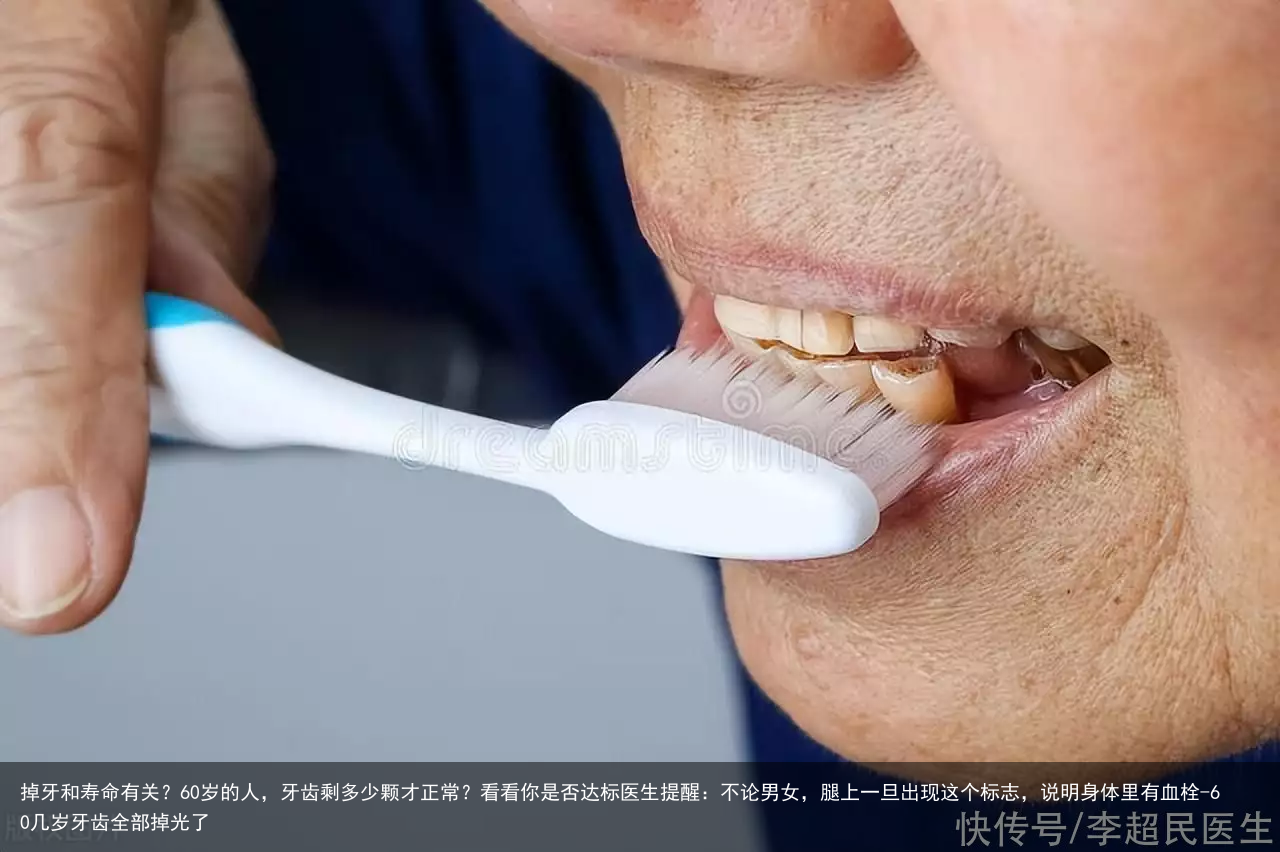 掉牙和寿命有关?60岁的人,牙齿剩多少颗才正常?看看你是否达标医生提醒:不论男女,腿上一旦出现这个标志,说明身体里有血栓-60几岁牙齿全部掉光了