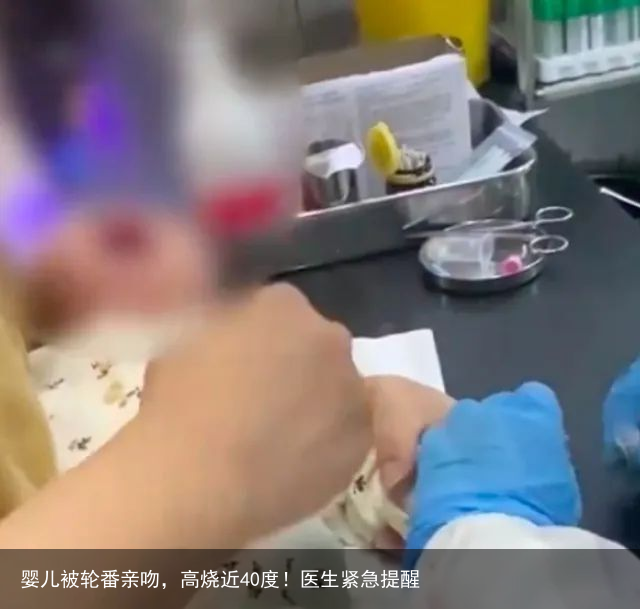 婴儿被轮番亲吻,高烧近40度!医生紧急提醒