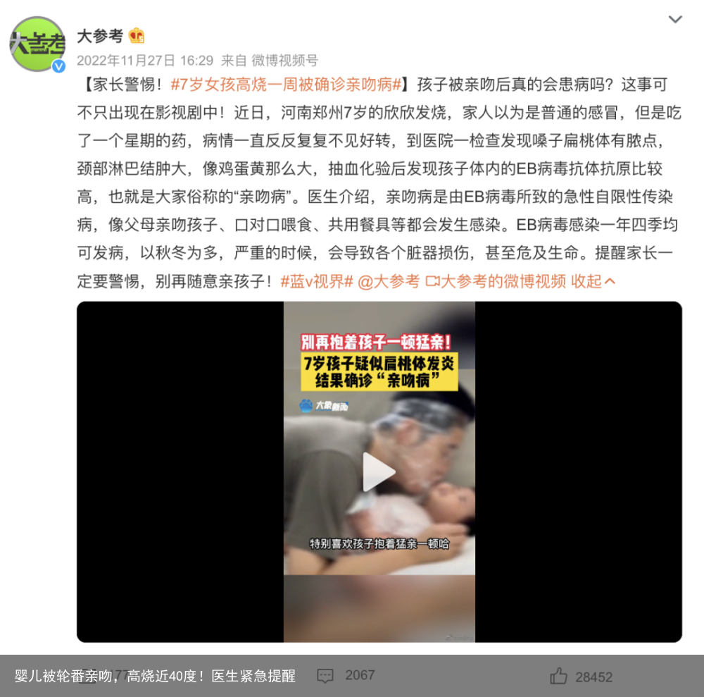 婴儿被轮番亲吻,高烧近40度!医生紧急提醒