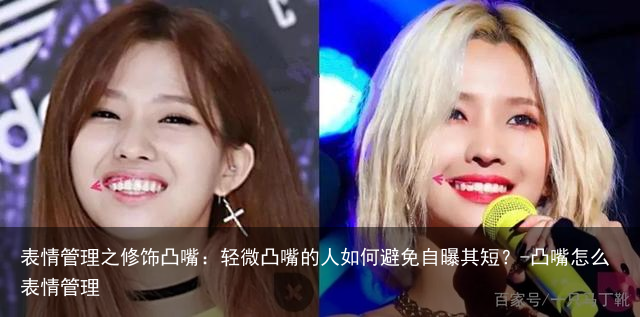 表情管理之修饰凸嘴:轻微凸嘴的人如何避免自曝其短?-凸嘴怎么表情管理