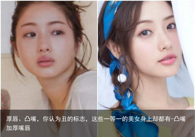 厚唇、凸嘴,你认为丑的标志,这些一等一的美女身上却都有-凸嘴加厚嘴唇