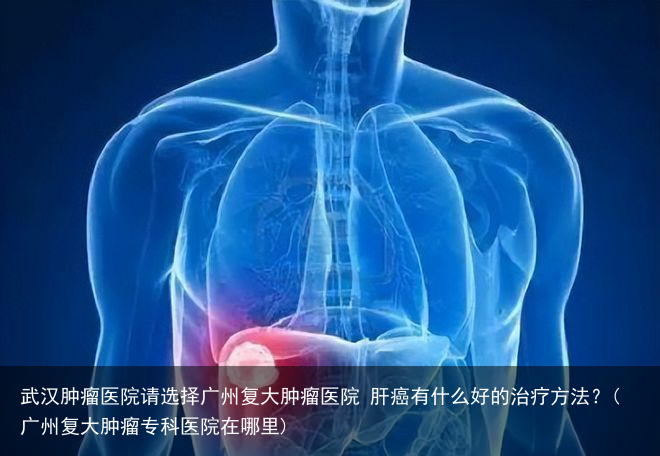 武汉肿瘤医院请选择广州复大肿瘤医院 肝癌有什么好的治疗方法?(广州复大肿瘤专科医院在哪里)