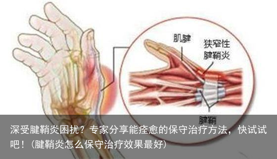 深受腱鞘炎困扰?专家分享能痊愈的保守治疗方法,快试试吧!(腱鞘炎怎么保守治疗效果最好)