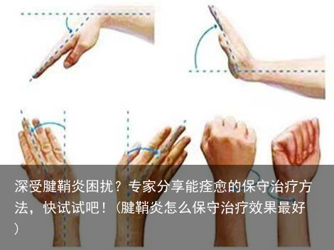 深受腱鞘炎困扰?专家分享能痊愈的保守治疗方法,快试试吧!(腱鞘炎怎么保守治疗效果最好)