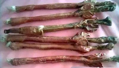 全国知名老中医男科专家杨栋医生:阳痿,该怎么调理?(名老中医男科验方)