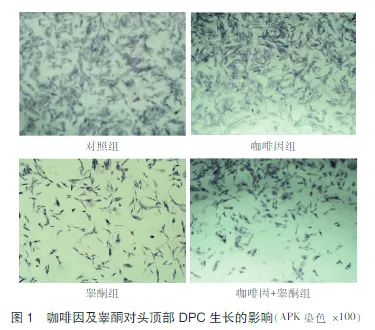 喝咖啡的好处与坏处有哪些?
