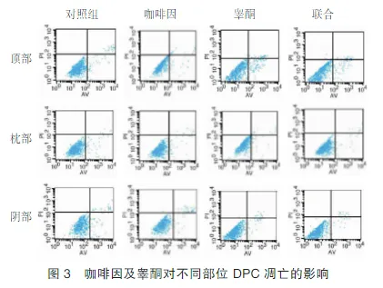 喝咖啡的好处与坏处有哪些?