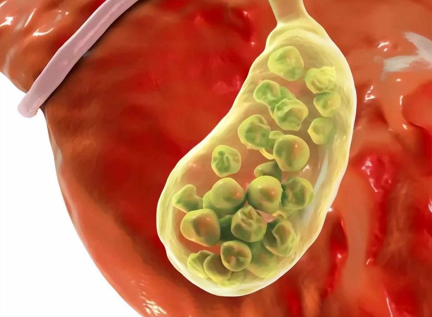 长期喝咖啡,不仅损伤神经、还致癌?研究结果公布,看完涨知识了