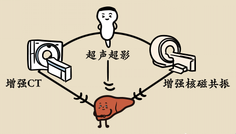 世界肝炎日 | 体检发现肝脏结节怎么办?这个检查最靠谱!