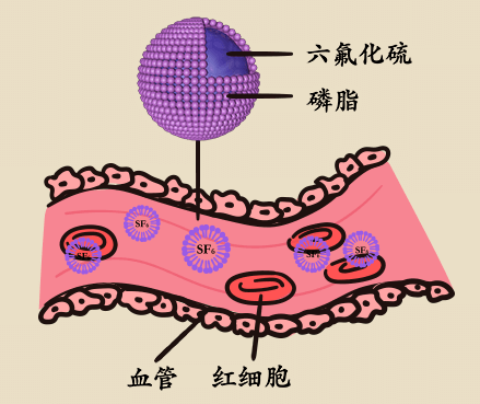 世界肝炎日 | 体检发现肝脏结节怎么办?这个检查最靠谱!