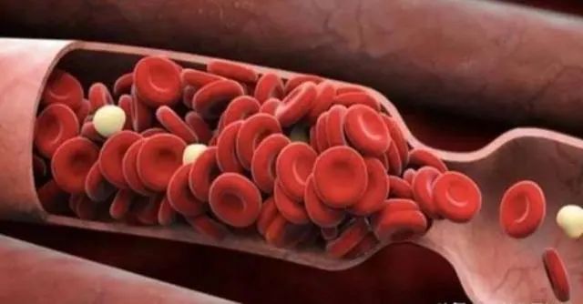 提醒:甘油三酯恢复到正常值,3物是降脂能手,没事多吃一吃