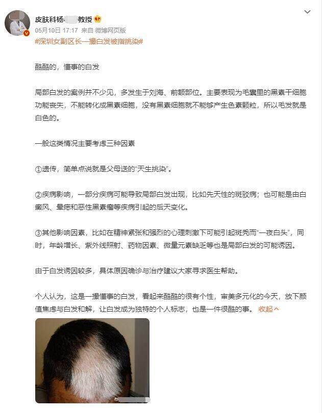 女副区长 “一撮白发”上热搜,压力大会导致白发提早或增多?(女区长被家暴致死最终判决)