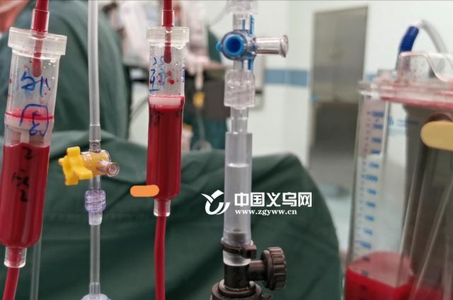 二胎妈妈遭遇凶险胎盘植入 死里逃生后写下2000字小作文(胎盘植入孩子还能保吗)