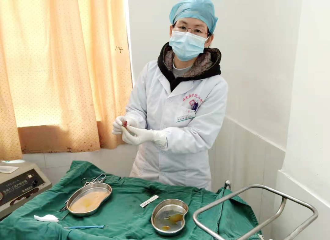 从高度鳞状上皮内病变走向癌症,宫颈锥切把她拦了下来-锥切高度鳞状上皮内病变累及腺体