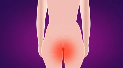 怎么判断肠子里有没有长息肉?身体里有这3个异常-如何判断肠有没有息肉