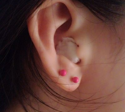 【偏方】牙疼快速止疼法-风油精牙疼快速止疼偏方图片