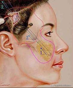 35岁后面部松弛,医生说这4种提升方式还不错-35岁下垂松弛的脸怎么办