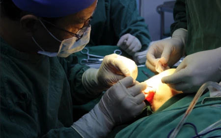 55岁做线雕没效果,来广州做拉皮手术,1周后像变了个人-线雕拉皮视频全过程播放