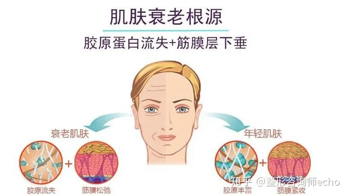 面部提升价格大概是多少?-面部提升怎么样