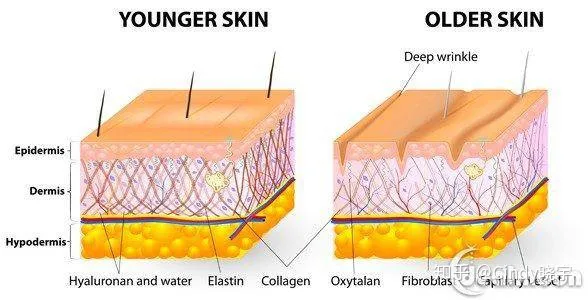 什么护肤品去皱纹好?-什么护肤品可以淡化皱纹