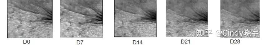 什么护肤品去皱纹好?-什么护肤品可以淡化皱纹