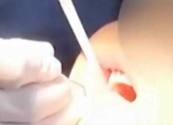 “功能性牙膏”热卖,10岁女孩为补牙却损失6颗牙(功能性牙膏的特点)