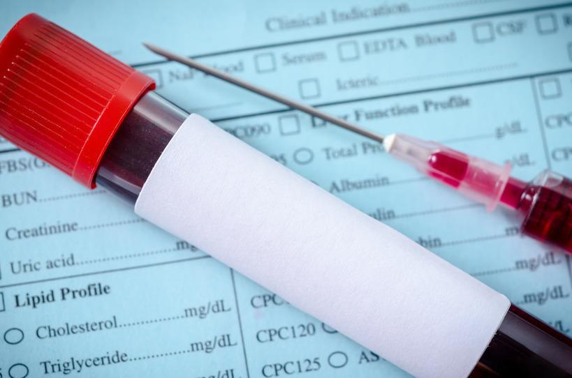 6大因素是导致甘油三脂偏高“罪魁祸首”,做好5件事,轻松降下来-造成甘油三酯高的原因是什么