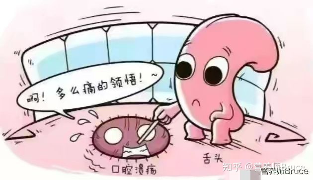 口腔溃疡有什么快速疗法?-口腔溃疡怎冶疗最好