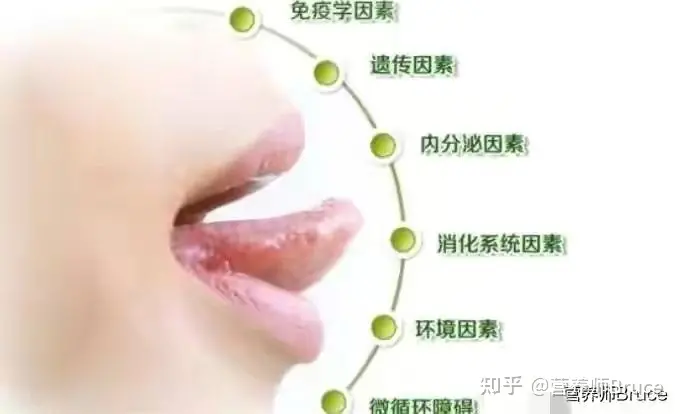 口腔溃疡有什么快速疗法?-口腔溃疡怎冶疗最好