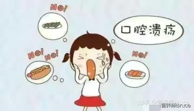 口腔溃疡有什么快速疗法?-口腔溃疡怎冶疗最好