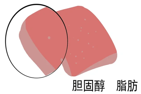 胆固醇高就不能吃鸡蛋和肉类?关于胆固醇,不少人有认知误区(胆固醇高不能吃鸡蛋对吗)