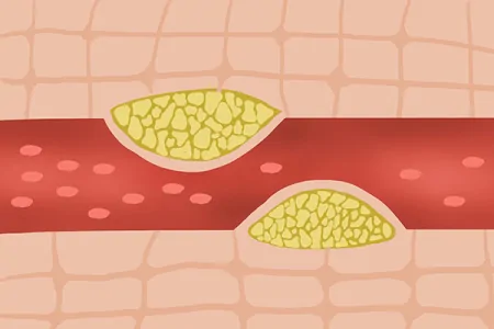 胆固醇高就不能吃鸡蛋和肉类?关于胆固醇,不少人有认知误区(胆固醇高不能吃鸡蛋对吗)