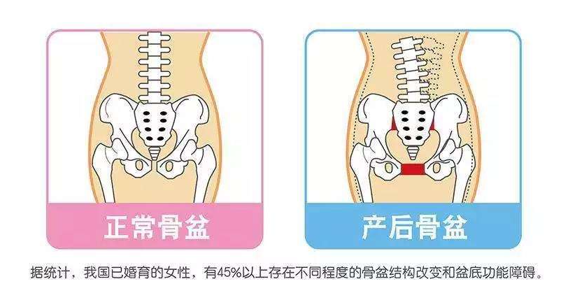 女性朋友生完宝宝后,到底要不要做产后修复-女性朋友生孩子