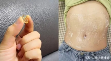 长了妊娠纹不能修复?错!用对方法,产后也能恢复“白净肚”-妊娠纹长了就不会消下去了吗