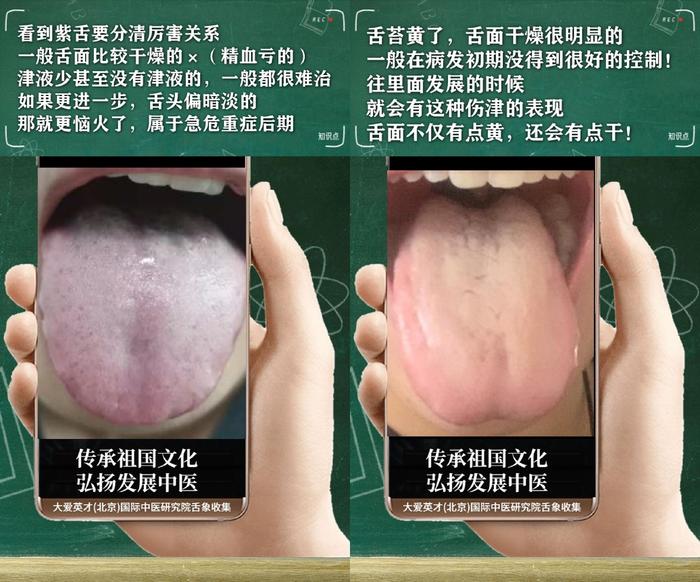 舌诊分析:生气、睡眠紊乱、水湿上泛、忽好忽坏很受影响-生气用中医学怎么说