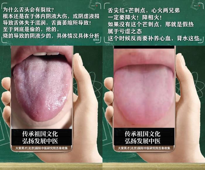 舌诊分析:生气、睡眠紊乱、水湿上泛、忽好忽坏很受影响-生气用中医学怎么说