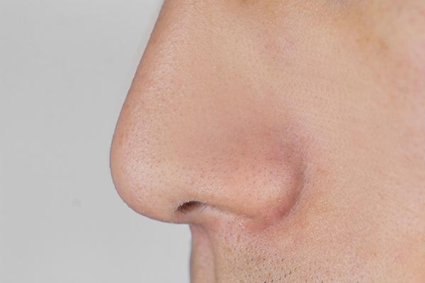 1个榴莲顶3只鸡,爱吃榴莲的人,身体得到了什么?是好是坏?(一只榴莲真的抵一只母鸡吗)