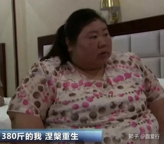 “安徽女”为爱减肥240斤却遭抛弃,未来路在何方-女孩为爱疯狂减肥