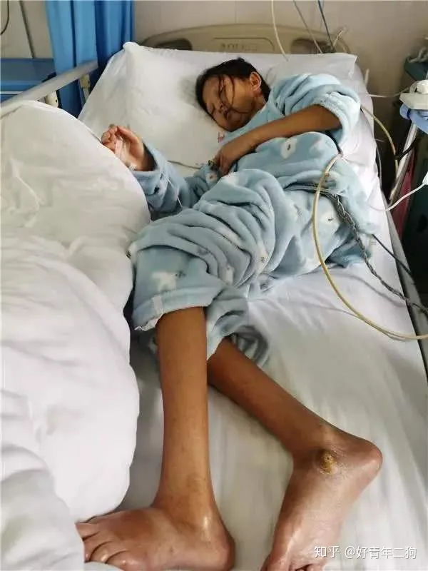 24岁,43斤,贵州女大学生吴花燕,死了!-贵州大学生吴花艳简历