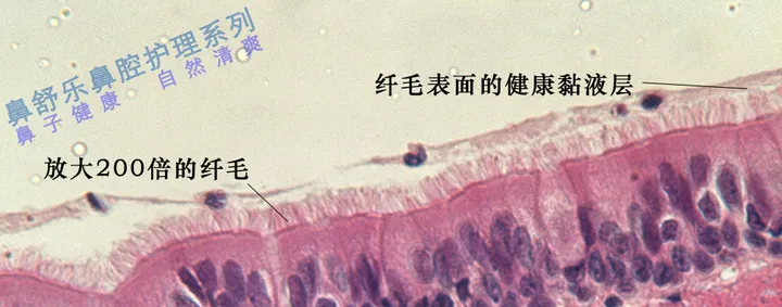 鼻窦炎如何根治?(儿童鼻窦炎的最明显五大症状)