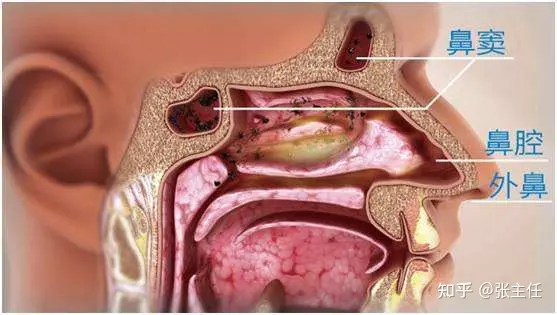 鼻窦炎怎么治疗能够根除?从医50年余年老中医教你这这样做,鼻窦炎远离你!(治疗鼻窦炎的13个偏方)