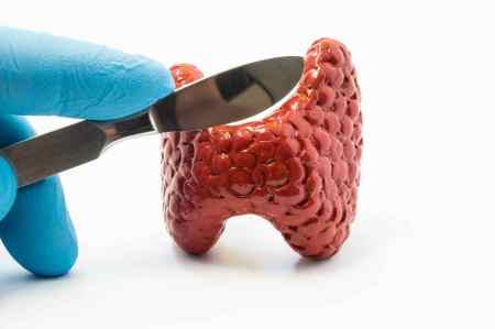 甲状腺有结节,白开水里加“一物”,抑制结节病变-甲状腺结节用什么泡水喝可以散结