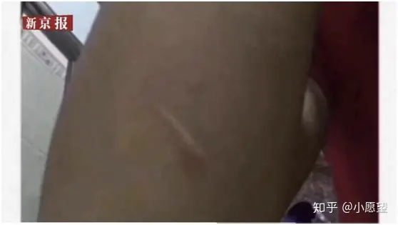 28岁年轻母亲带俩幼子自杀:容不下的婆家,回不去的娘家-安徽29岁妈妈带两孩子视频