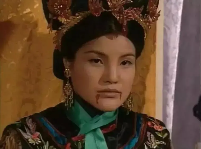 知名女艺人当街遭暴徒殴打!缝了11针!她的回应是...-明星被打要害