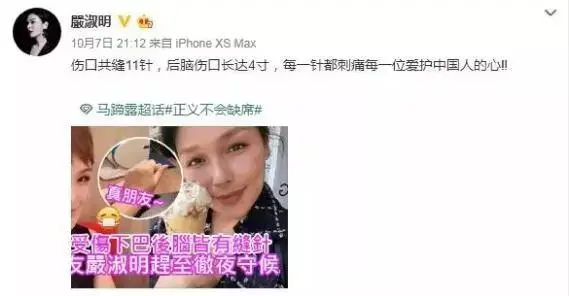 知名女艺人当街遭暴徒殴打!缝了11针!她的回应是...-明星被打要害