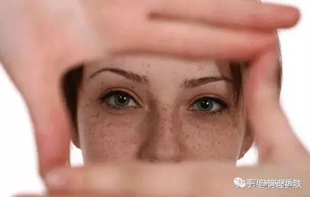 可见一“斑”,色斑及色沉的预防及治疗!-可见一斑为什么是斑点的斑?